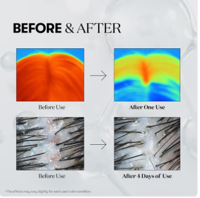 Valere PDRN Reedle Shot Hair Ampoule